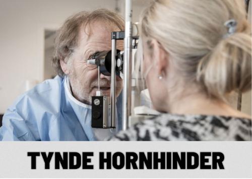 Tynde hornhinder